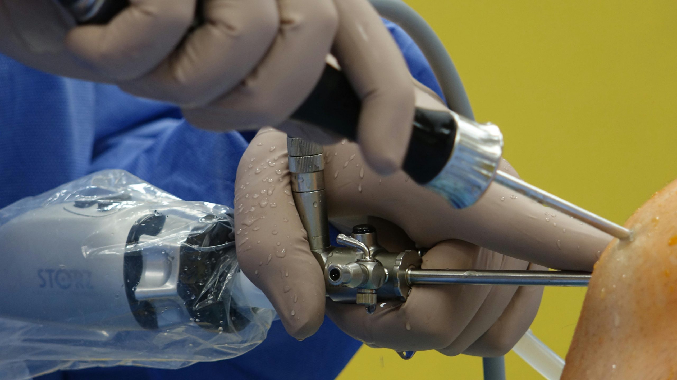 close-up of a surgeon's hand performing a knee surgery